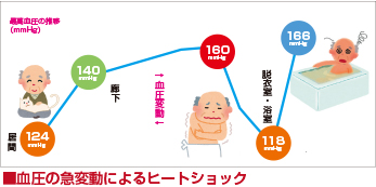 血圧の急変動によるヒートショック